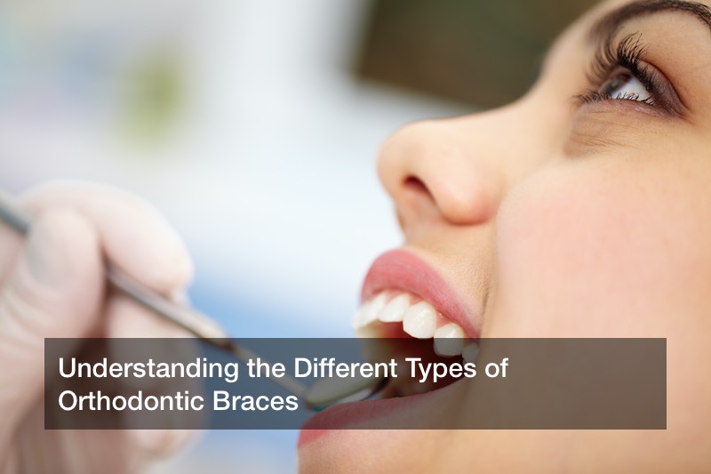 Understanding the Different Types of Orthodontic Braces