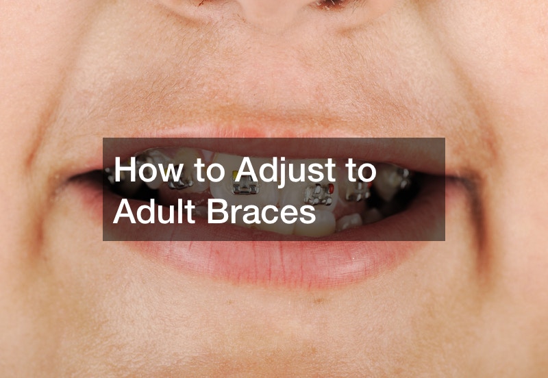 How to Adjust to Adult Braces