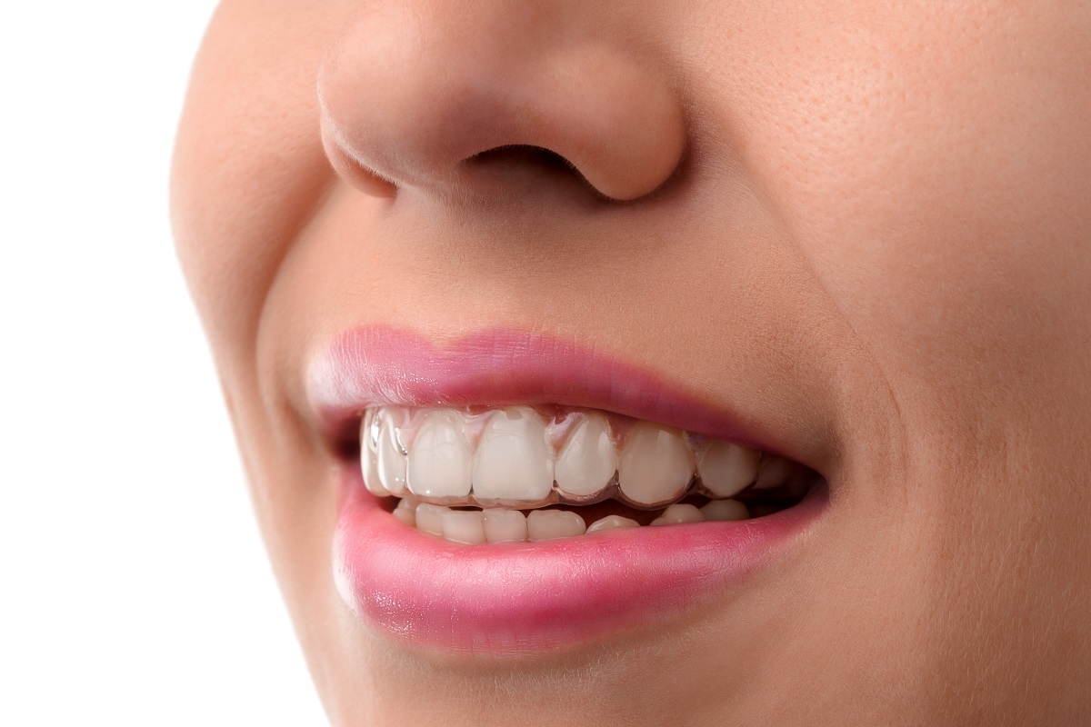 woman with aligners