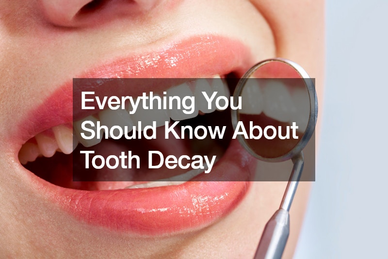 Everything You Should Know About Tooth Decay