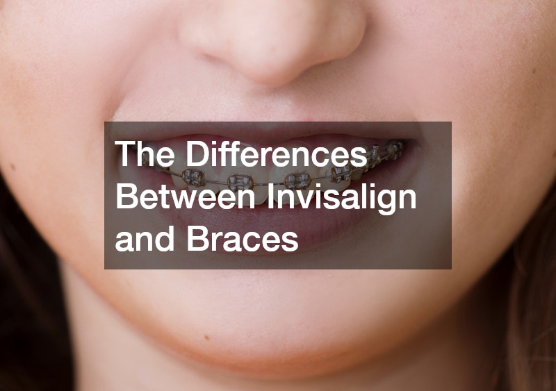 The Differences Between Invisalign and Braces